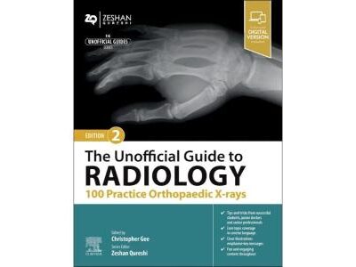 The Unofficial Guide to Radiology: 100 Practice Orthopaedic X-rays (Unofficial Guides)