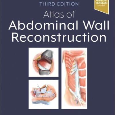Atlas of Abdominal Wall Reconstruction