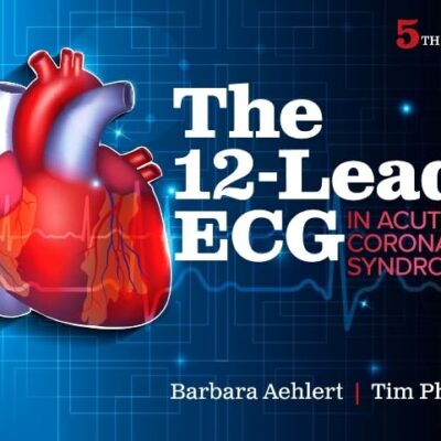 The 12-Lead ECG in Acute Coronary Syndromes