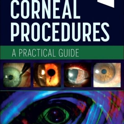 In-Office Corneal Procedures: A Practical Guide