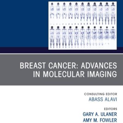 BREAST CANCER ADVANCES IN MOLECULAR IMAGING AN ISSUE OF PET CLINICS (HB 2023): 18 (Clinics: Radiology)