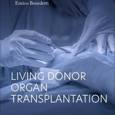 Living Donor Organ Transplantation