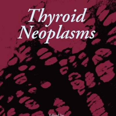 Thyroid Neoplasms (Volume 4) (Advances in Molecular and Cellular Endocrinology, Volume 4)