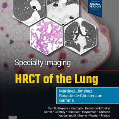 Specialty Imaging: HRCT of the Lung