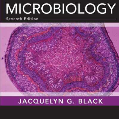 MICROBIOLOGY: PRINCIPLES AND EXPLORATIONS, 7TH EDN, INTERNATIONAL STUDENT VERSION