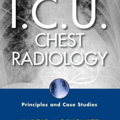 I.C.U. Chest Radiology: Principles and Case Studies
