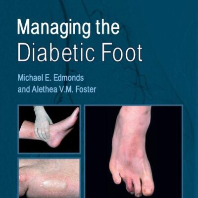 Managing The Diabetic Foot 3Ed (Pb 2014)