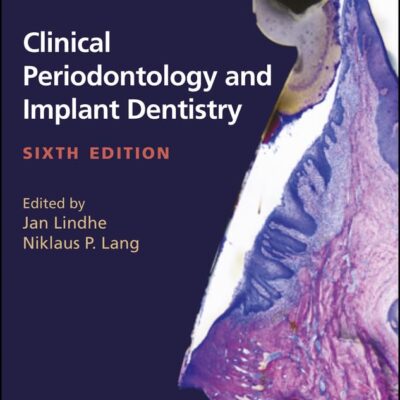 Clinical Periodontology And Implant Dentistry 6Ed 2 Vols Set (Hb 2015) Special Price