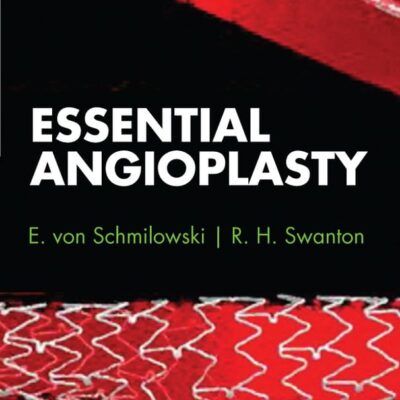 Essential Angioplasty