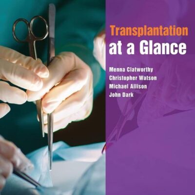 Transplantation at a Glance