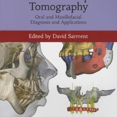 Cone Beam Computed Tomography: Oral and Maxillofacial Diagnosis and Applications