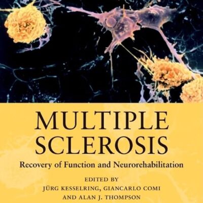 Multiple Scierosis