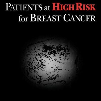 Management of Patients at High Risk for Breast Cancer