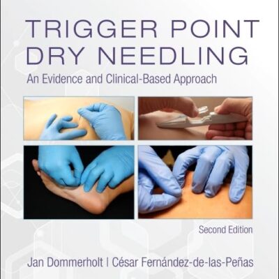 Trigger Point Dry Needling -2E