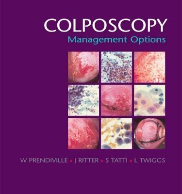 Colposcopy: Management Options