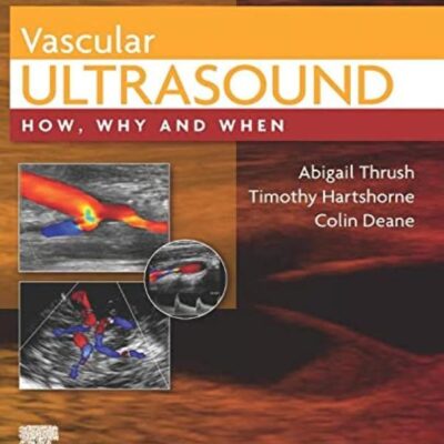 Vascular Ultrasound