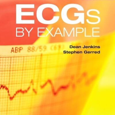 ECGs by Example-3ED