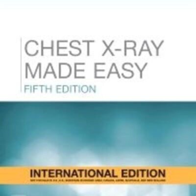 Chest X-Ray Made Easy(IE)-5E