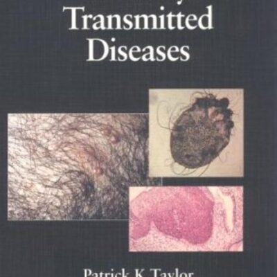 Diagnostic Picture Tests In Sexually Transmitted Diseases