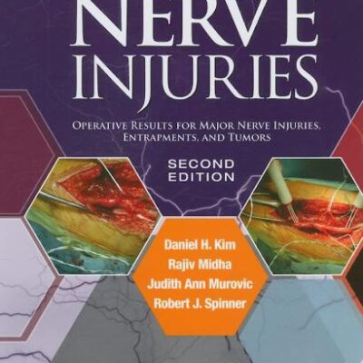Kline and Hudson's Nerve Injuries: Operative Results for Major Nerve Injuries, Entrapments and Tumors