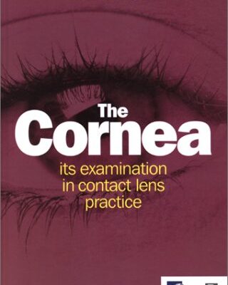 The Cornea: Its Examination in Contact Lens Practice