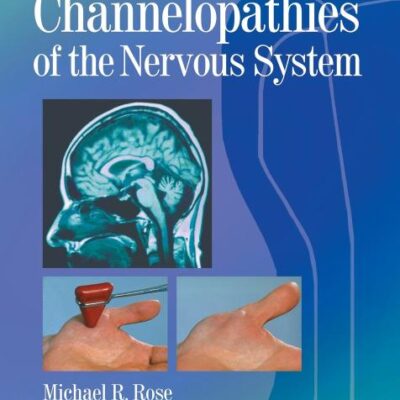 Channelopathies of the Nervous System