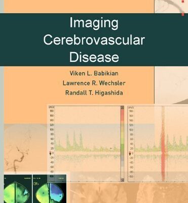 Imaging Cerebrovascular Disease