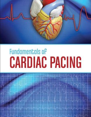 Fundamentals of Cardiac Pacing