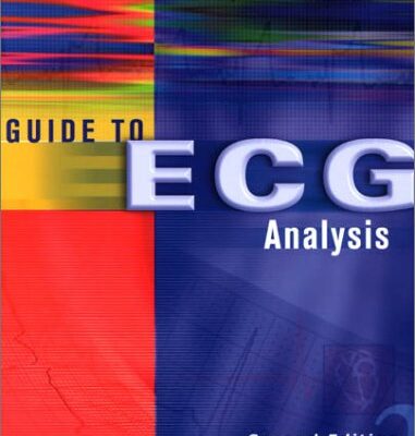 Guide to ECG Analysis