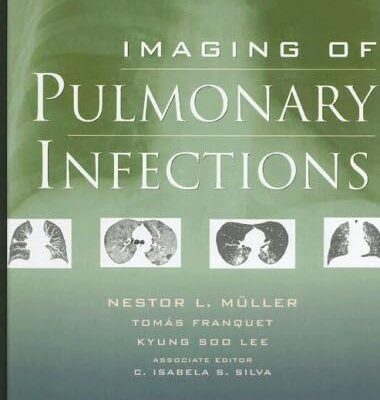 Imaging of Pulmonary Infections