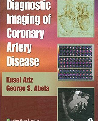 Diagnostic Imaging Of Coronary Artery Disease Aziz, Kusai And Abela, George S.