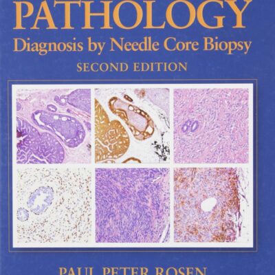 Breast Pathology: Diagnosis by Needle Core Biopsy