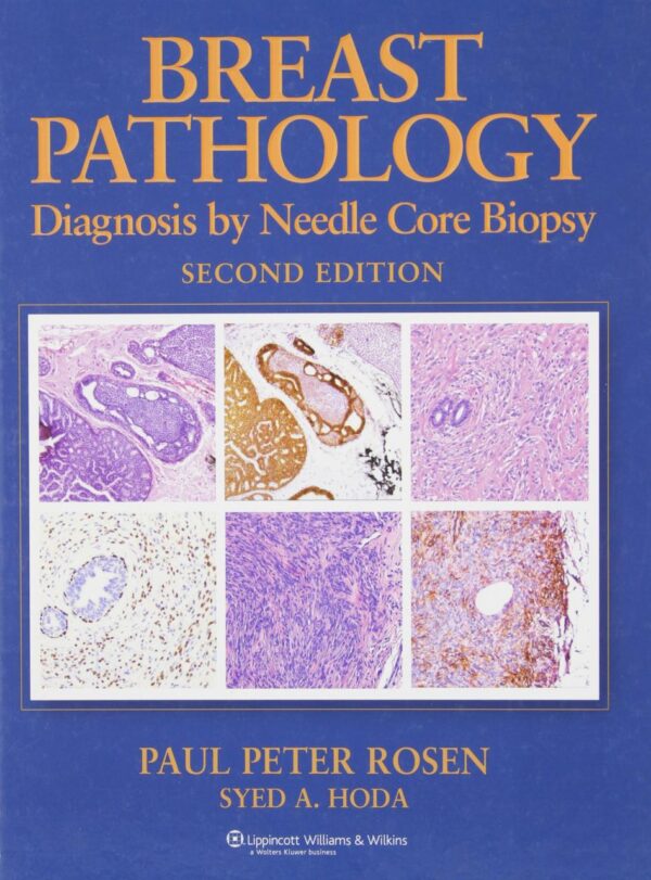 Breast Pathology: Diagnosis by Needle Core Biopsy