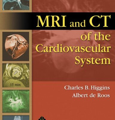 MRI and CT of the Cardiovascular System