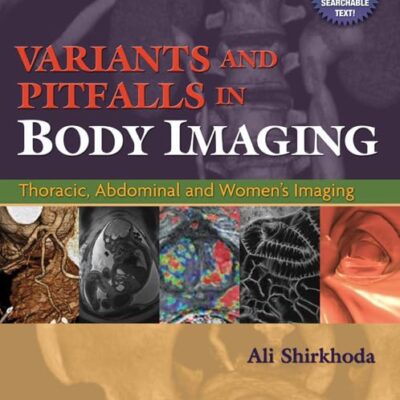 Variants and Pitfalls in Body Imaging: Thoracic, Abdominal and Women's Imaging