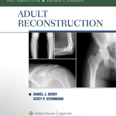 Adult Reconstruction (Orthopaedic Surgery Essentials Series)