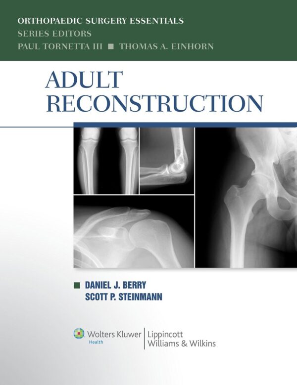 Adult Reconstruction (Orthopaedic Surgery Essentials Series)