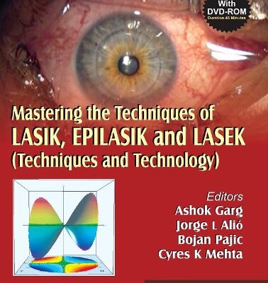 Mastering the Techniques of LASIK, EPILASIK and LASEK: Techniques and Technology