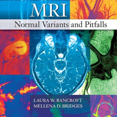 MRI Normal Variants and Pitfalls