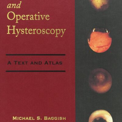 Diagnostic and Operative Hysteroscopy: A Text and Atlas