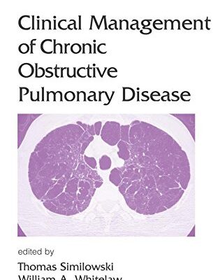 Clinical Management of Chronic Obstructive Pulmonary Disease (Lung Biology in Health and Disease)