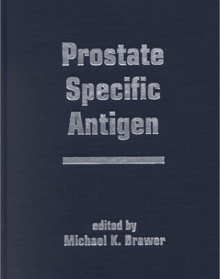 PROSTATE SPECIFIC ANTIGEN