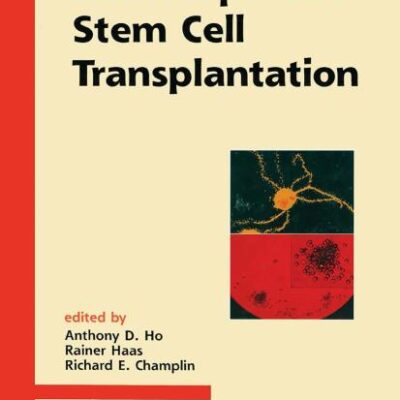 HEMATOPOIETIC STEM CELL TRANSPLANTATION