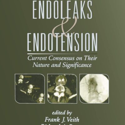 Endoleaks Endotensions