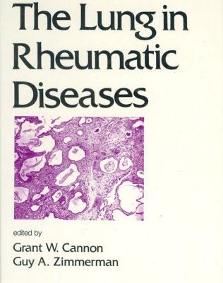 The Lung in Rheumatic Diseases: 45 (Lung Biology in Health and Disease)