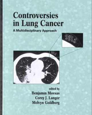 CONTROVERSIES IN LUNG CANCER:A MULTIDISCIPLINARY APPROACH