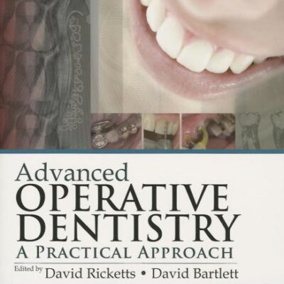 Advanced Operative Dentistry: A Practical Approach