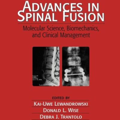 ADVANCES IN SPINAL FUSION