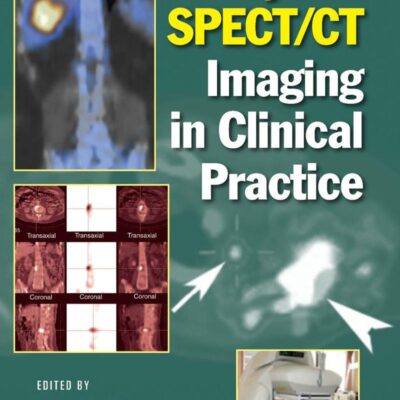 HYBRID SPECT CT IMAGING IN CLINICAL PRACTICE