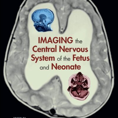 IMAGING THE CENTRAL NERVOUS SYSTEM OF THE FETUS AND NEONATE